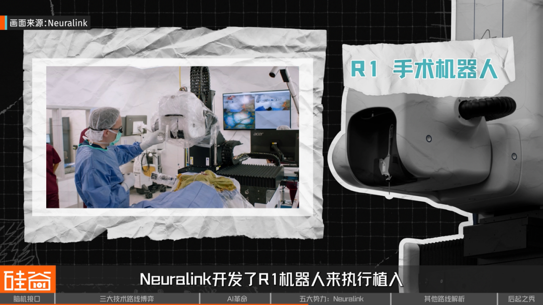 脑机接口大盘点：从科幻到现实，谁在引领这场“读心术”革命？