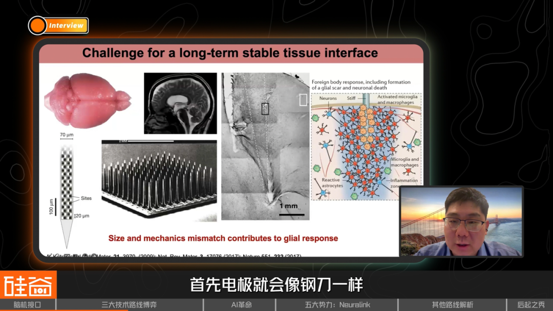 脑机接口大盘点：从科幻到现实，谁在引领这场“读心术”革命？
