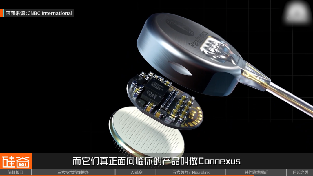 脑机接口大盘点：从科幻到现实，谁在引领这场“读心术”革命？