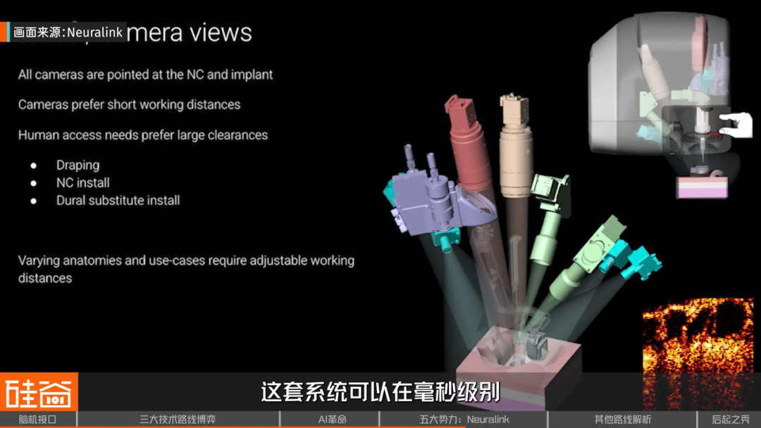 脑机接口大盘点：从科幻到现实，谁在引领这场“读心术”革命？
