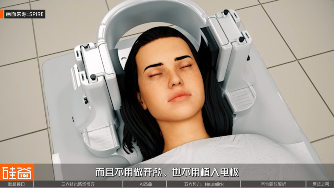 脑机接口大盘点：从科幻到现实，谁在引领这场“读心术”革命？