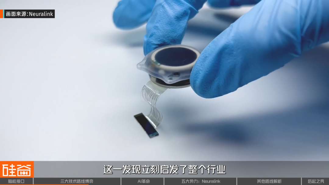 脑机接口大盘点：从科幻到现实，谁在引领这场“读心术”革命？