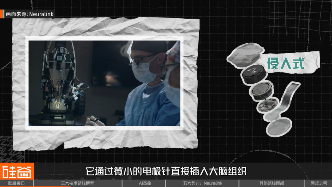 脑机接口大盘点：从科幻到现实，谁在引领这场“读心术”革命？